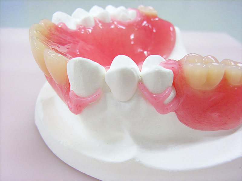入れ歯と歯茎の密着